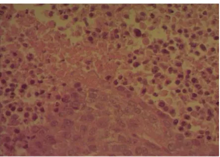 Figure 4. Histological staining of tumor tissue with hematoxylin-eosin. Figure presents the tumor tissue of mouse after subcutaneously formations of a little differentiated population of cells with cellular and administration of suspension tumor cells Hepa