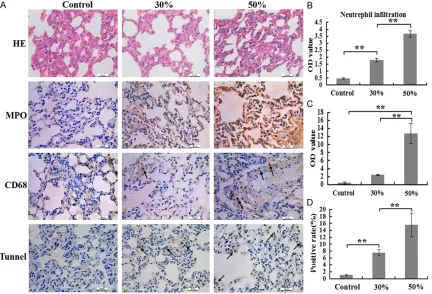 Figure 2. Comparison of inflammatory cells numbers and cells apoptosis rates of lung at 24 h post burn in 30%, 50% TBSA with a full-thickness burn groups and control group