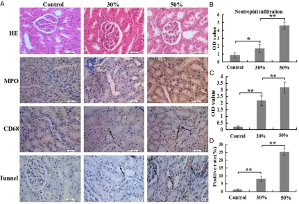 Figure 4. Comparison of inflammatory cells numbers and cells apoptosis rates of renal at 24 h post burn in 30%, 50% TBSA with a full-thickness burn groups and control group