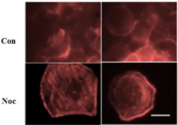 Figure 5. Cell radius measurement. HeLa cells were treated with nocodazole at concentration of 1 µM for 24 hours