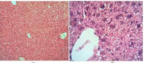 Figure 13. Liver with 1st (a) and 2nd (b) degree of severity 