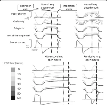 Fig. 3 Capnograms and airway flows recorded. Capnograms were recorded with an HFNC flow of 10–60 L/min in each lung model