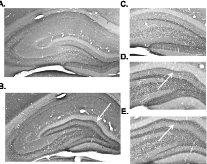 Figure 1.6. ZnT-3 labeling of mossy fiber sprouting in animals 60 and 