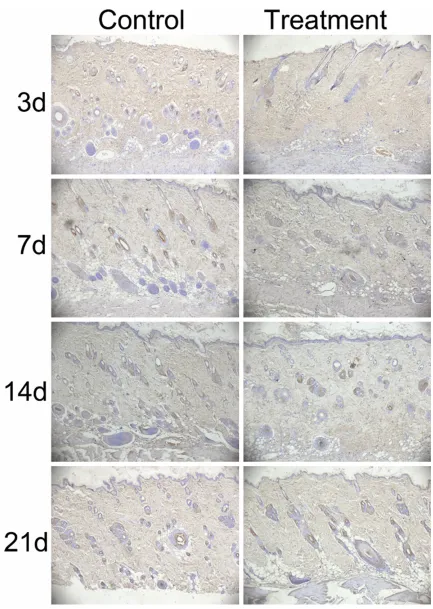 Figure 2. EMMPRIN antibody treatment reduced angiogenesis in the ulcers (Left): Representative angiogenesis of control ulcers by endothelial cell marker (CD34) immunohistochemistry; (Right): Representative angiogenesis of EMMPRIN antibody treatment ulcers