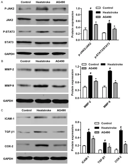 Figure 4. Effect of AG490 on JAK2/STAT3 pathway and inflammation. AG490 treatment suppressed activation of JAK2/STAT3 pathway and increase of inflammation related protein, MMP2 and MMP-9