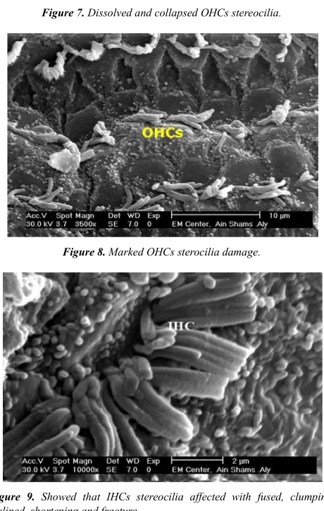 Figure 10. Showed that OHCs replaced by scar formation in the outermost row with disarrayed stereocilia