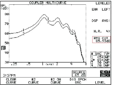 Figure 3: The FM offset for this test is 85.9 - 89.5 = -3.6. The FM gain  level needs to be increased by about 3 dB