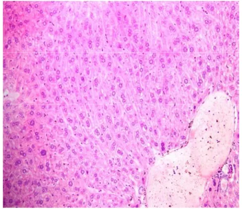 Figure 1. Liver section of control 1st mice showing unremarkable liver tissue (100 X)