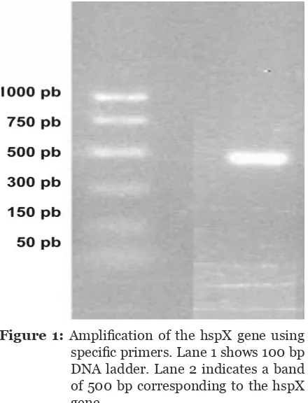 Figure 1: Amplification of the hspX gene using 