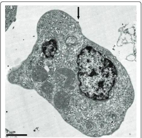 Figure 4 Example of a triply-infected K7 cellparticle budding from the plasma membrane (arrow)