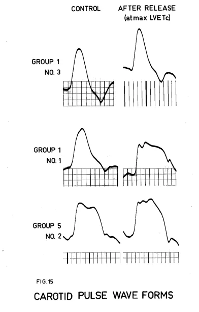 FIG. 15 
