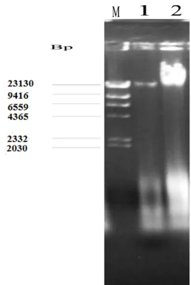 Figure 1. Electrophoretic patterns for plasmid profile of bacterial isolates from hospital environmental surfaces