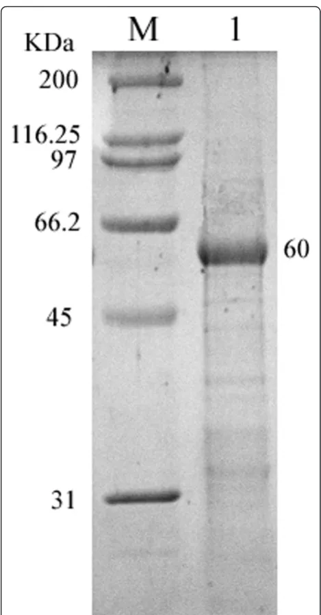 Figure 6 SDS-PAGE analysis of the purity of recombinantplasmid pET32b-UL16 from Rossetta (DE3)