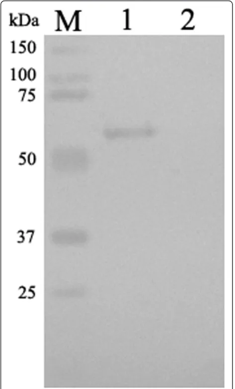 Figure 8 Intracellular localization of the UL16 protein in DEVCHv infected DEFs. Mock- and DEV CHv infected cells were fixedat the indicated times postinfection and processed for indirectimmunofluorescence