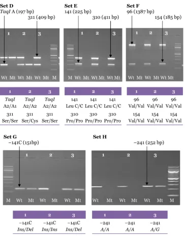 Figure  6: Electrophoresis pattern for the second PCR amplification from 3 genomic DNA samples carried out with the specific primers using the final optimised PCR for Set D (Ser311Cys and TaqI A), Set E (Pro310Ser, Leu141Leu), Set F (Val96Ala and Val154Ile