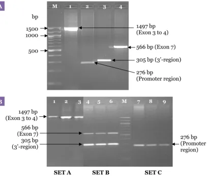 Figure  3: Electrophoresis pattern for the first PCR carried out with the specific primers