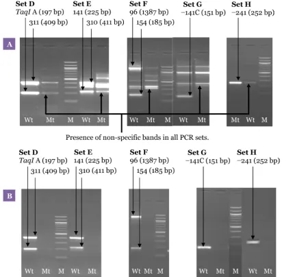 Figure 5: Optimisation of the allele-specific multiplex PCR. Agarose gel electrophoresis of the products from the second PCR showing the effect of different MgCl2 and Taq polymerase concentrations