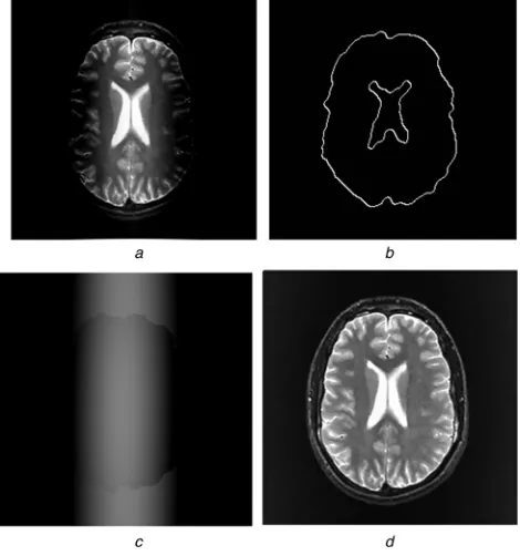 Fig. 8Removal of distortion