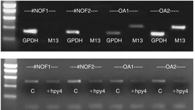 Figure 5. Combined determination of mRNA expression (top) and DNA methylationstatus (bottom).Results are shown for two control samples, obtained from patients who had sustained afracture of the neck of the femur (#NOF), and two osteoarthritic patients (OA)
