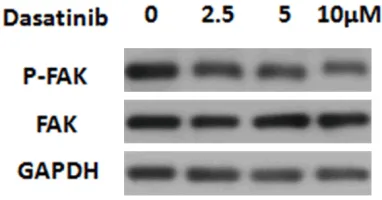 Figure 4. Dasatinib-induced apoptotic cells were investigated by Annexin V/PI staining treated with Dasatinib for 48 hr.