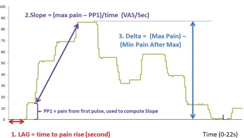Figure 2 Selection of Key Features from an example TS response curve.