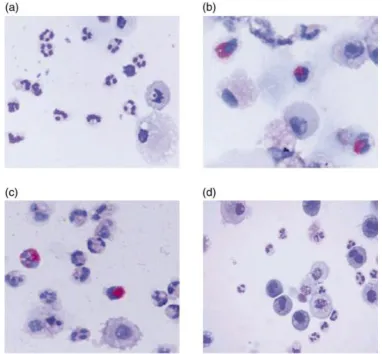 FIGURE 2.3. Sputum cytospins showing four inflammatory subtypes of asthma: (a) 