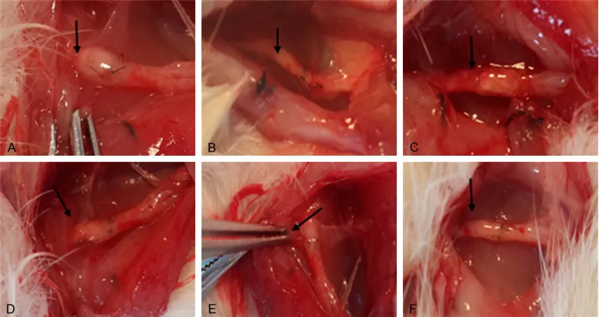 Figure 2. Gross observation of sciatic nerve regeneration after 8 (A) or 12 (B) weeks following sciatic nerve tran-section surgery in rats with direct suturing (A and D), nerve conduits (B and E), or PDLLA films (C and F)