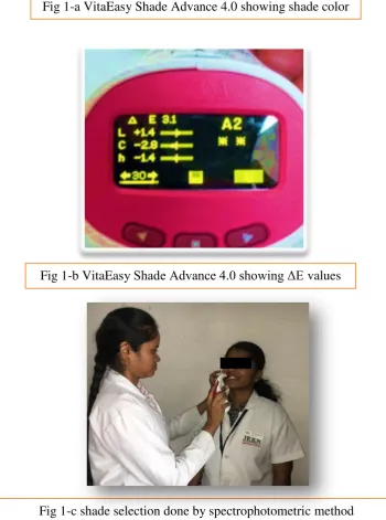 Fig 1-b VitaEasy Shade Advance 4.0 showing ΔE values 