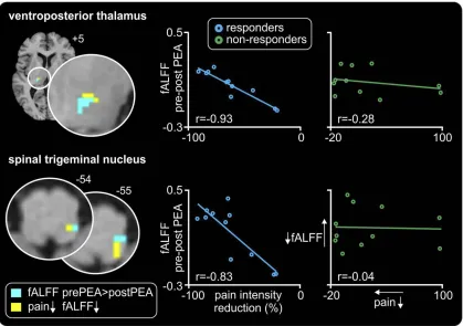 Figure 4 Relationships between changes in pain intensity and infra-slow oscillations as a result of palmitoylethanolamide (PEA) treatment