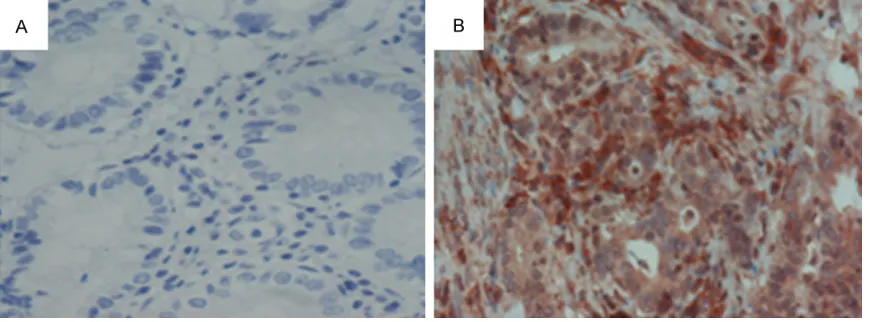 Table 1. Inhibition effect of different concentrations of TSA conducted on BGC-823 gastric cancer cells