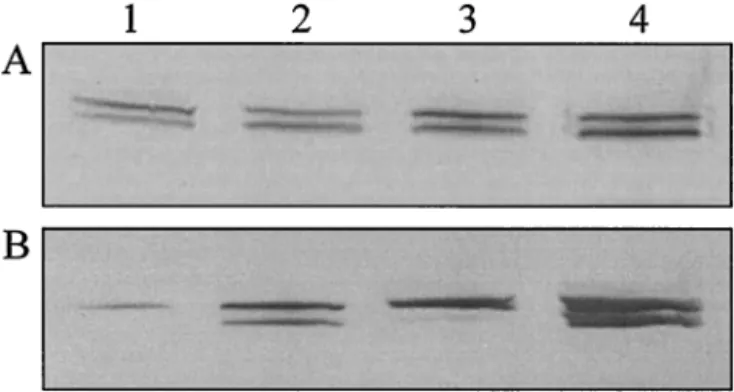 TABLE 2. Total PFL protein level during exponential growth of L. lactis MG1363