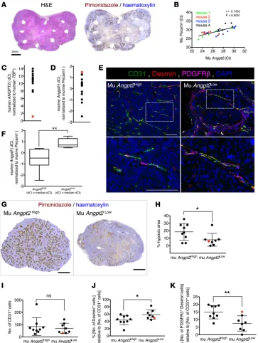 Figure 4. Cancer cell influence on Ang2 expression levels defines vascular integrity in breast cancer patient–derived xenografts