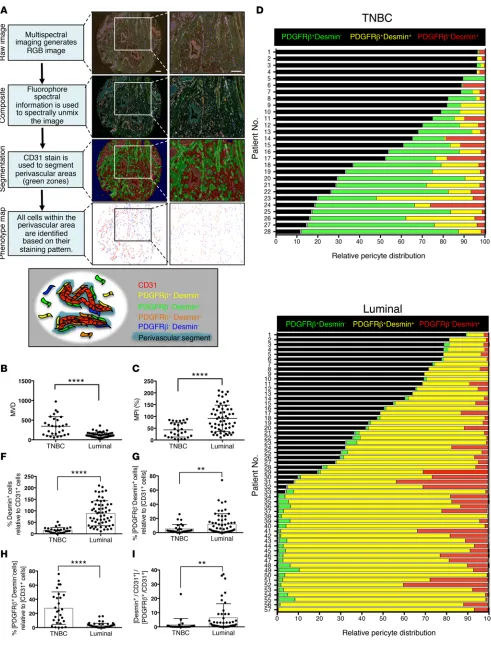 Figure 1. Triple-negative and luminal breast cancer subtypes present distinct pericyte coverage