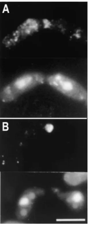 Table IV), suggesting that expression of the FH3 domain interfered with normal Fus1 function.