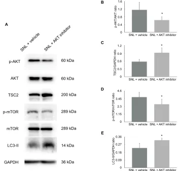 Figure 3 (A) The expression of aKT/Tsc2/mTOR pathway was analyzed in vehicle + snl group and aKT inhibitor + snl group