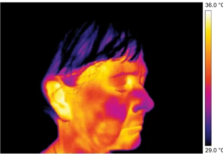 Figure 3 Thermography of orofacial area before fifth (final) therapy session.