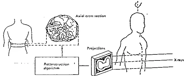 Fig. 1-3 Image reconstruction using x-ray CT scanners. 