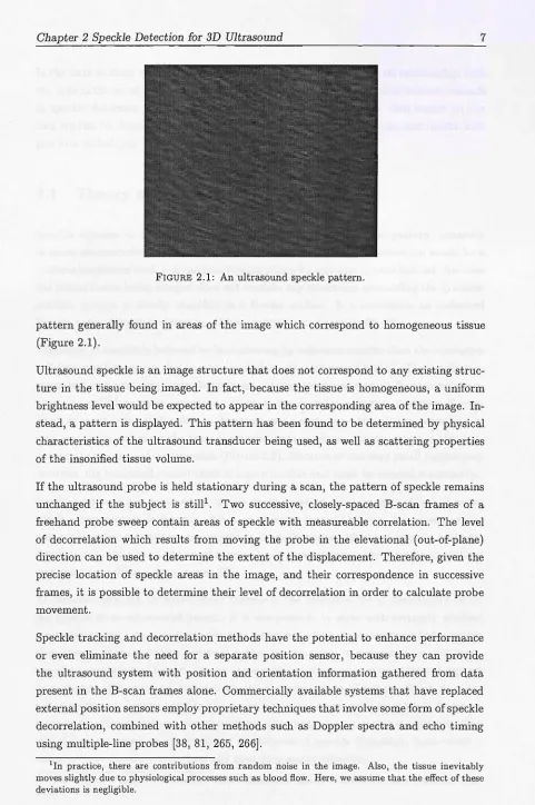 FIGURE 2.1: An ultrasound speckle pattern. 