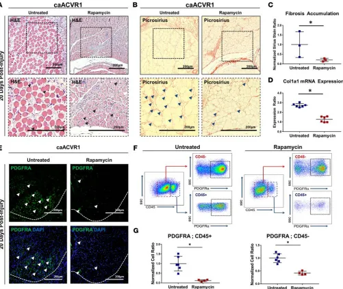 Figure 2. Rapamycin eliminates fibrosis associated with hyperactive BMP signaling. (arrowheads indicate fibrosis)