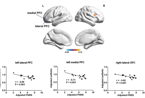 Figure S1 Frontal brain areas whose ReHo was correlated with PHN pain (with age and gender regressed out).between the ReHo signal from regions of interest and pain scores.Abbreviations:Notes:Puncorrected)