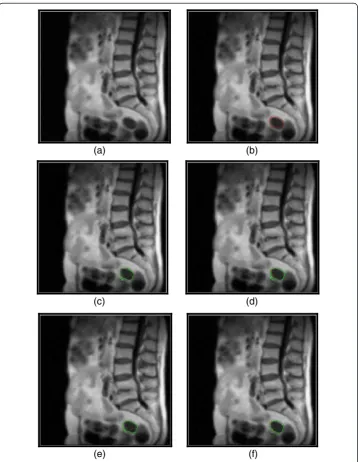 Fig. 6 Performance of the proposed method on a blurred medical image, compared to the DWT basedmethod with the weak objects