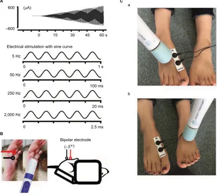 Figure 1 Measurement of the sensory threshold.Notes: (A) Four types of sine wave electrical stimulation were used for sensory threshold measurement: 5, 50, 250, and 2,000 hz