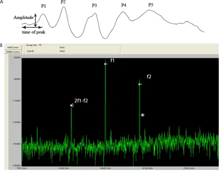 Figure 1. Illustrations of the methods to measure wave I of click and DPOAE. A. ABR wave I amplitude analysis includes three parts: time of peak (from beginning to Ip), SPL of click and amplitude of wave I (Ip-In)