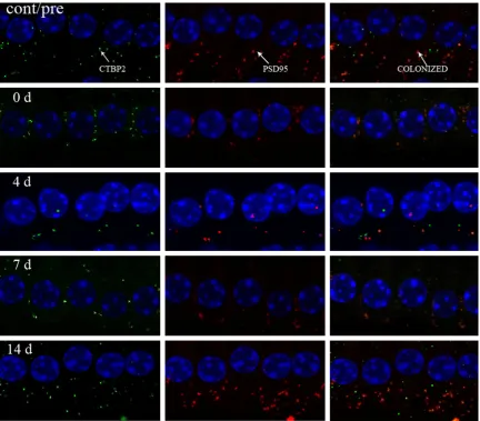 Figure 5. Change of RIBEYE/CtBP2 in confocal microscopy in control group (cont/pre), 0 day group (0 d), 4 day group sure (p < 0.05)
