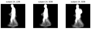 Fig. 1: Average silhouette representing subject 24ture is LDB, middle picture is SDB, walking normally, right: left pic-picture is SDB, carrying a bag
