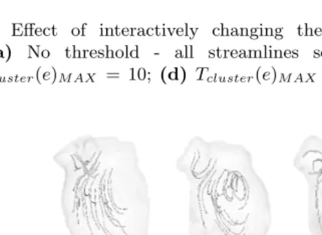 Fig. 2. Eﬀect of interactively changing the maximum total correlation thresh-(c)old. (a) No threshold - all streamlines selected