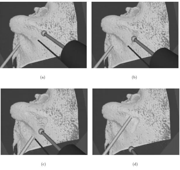 Figure 10: A virtual burring sequence. Here we show a typical bone cutting sequence per- per-formed in the mastoid region