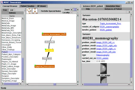 Fig. 3. The generic client application has hierarchical, list and TouchGraph [9] viewsof the ontology