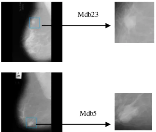 Figure  2. ROI  (174x174)  Obtained  from  mdb5  and  mdb23 