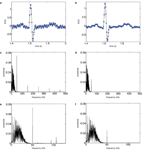 Figure 4. A segment of an ECG signal without (left column) and with (right column) anti-alias filtering